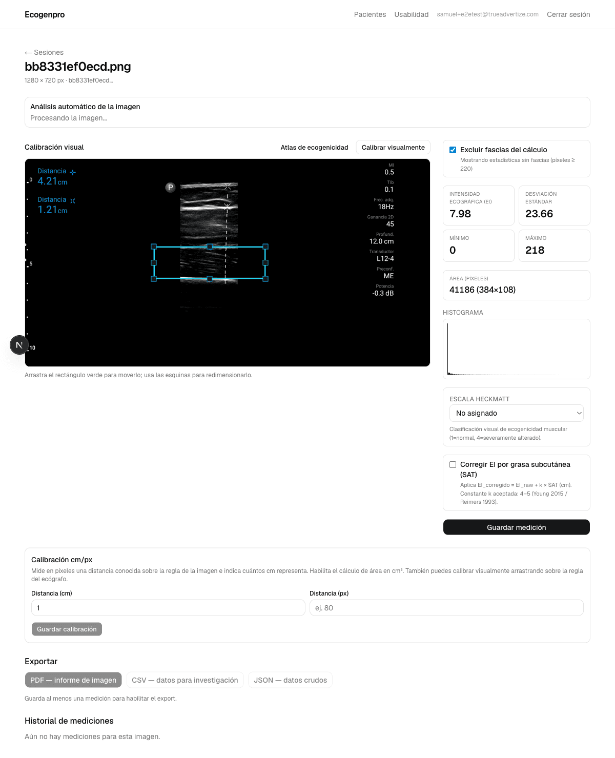 Editor de mediciones · ROI rectangular sobre recto femoral